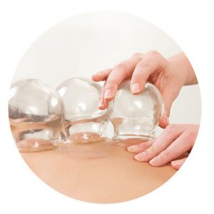 palms acupuncture treatment 300 cupping